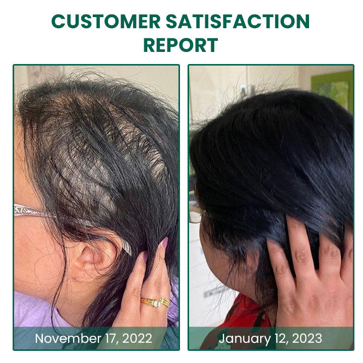 Oveallgo™ Glamor Ginger Essential Hair Growth Cream