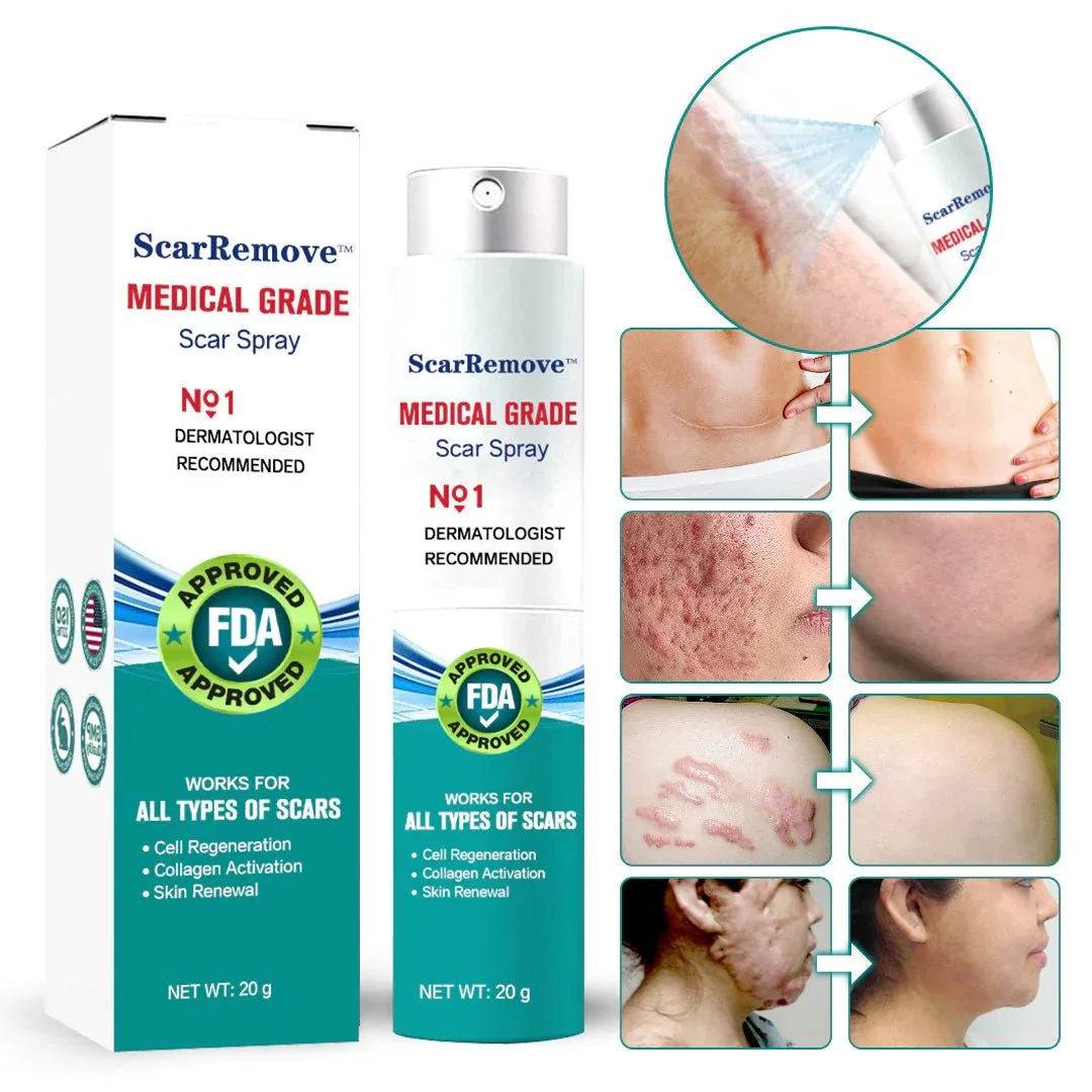 ❤️ScarRemoveTM Advanced Scar Spray For All Types of Scars - For example Acne Scars, Surgical Scars and Stretch Marks ⚡️⚡️⚡️