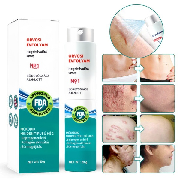 ❤️Specialus randų purškalas visų tipų randams – pavyzdžiui, spuogų randams, chirurginiams randams ir strijoms ⚡️⚡️⚡️