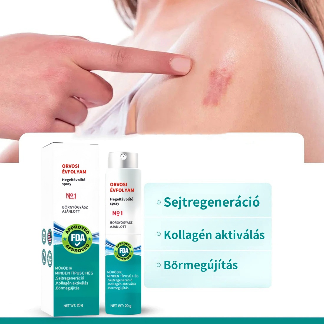 ❤️Specialus randų purškalas visų tipų randams – pavyzdžiui, spuogų randams, chirurginiams randams ir strijoms ⚡️⚡️⚡️