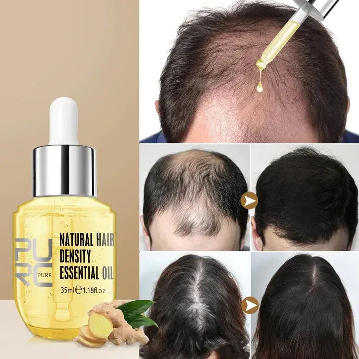 Hair Growth Essential Oil – Reclaim Your Luscious Locks!