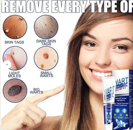 Wart Remover Ointment | Buy 1 Get 1 Free | 2 PCS