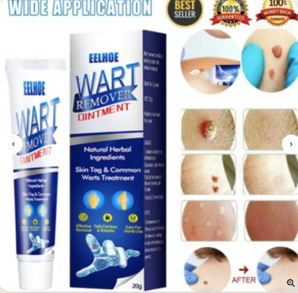 Wart Remover Ointment | Buy 1 Get 1 Free | 2 PCS