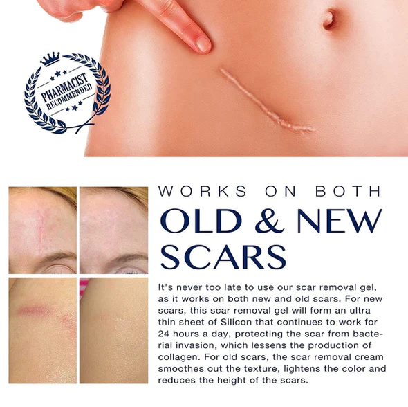 (🎁49%OFF🎁)GFOUK ADVANCED SILICONE GEL FOR SKIN RENEWAL