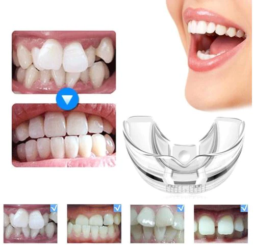 Plus Protections™️ Teeth Straightener