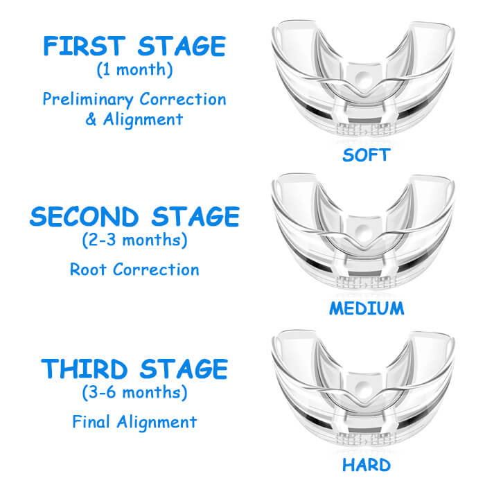 Plus Protections™️ Teeth Straightener