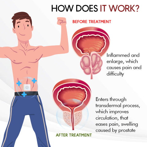 Prostate Treatment Patch (30pcs)