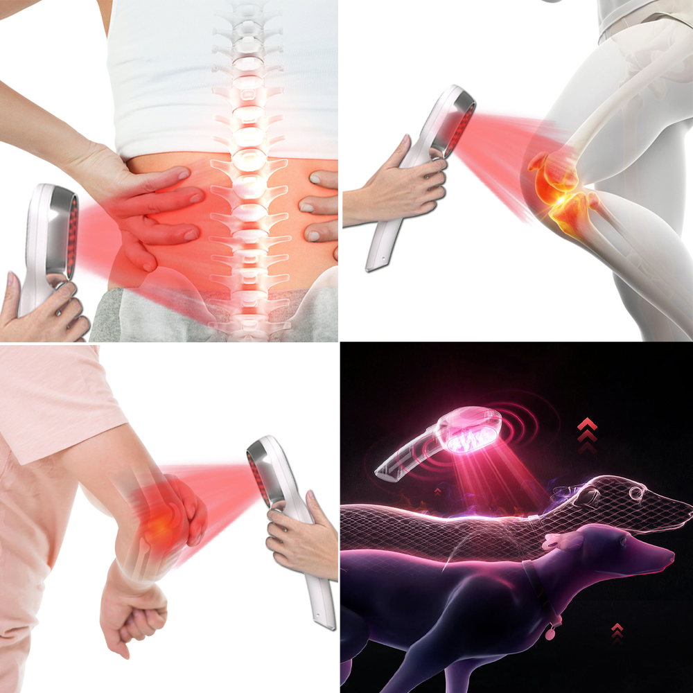 DERNOX™ LLLT Handheld Pain Management Device