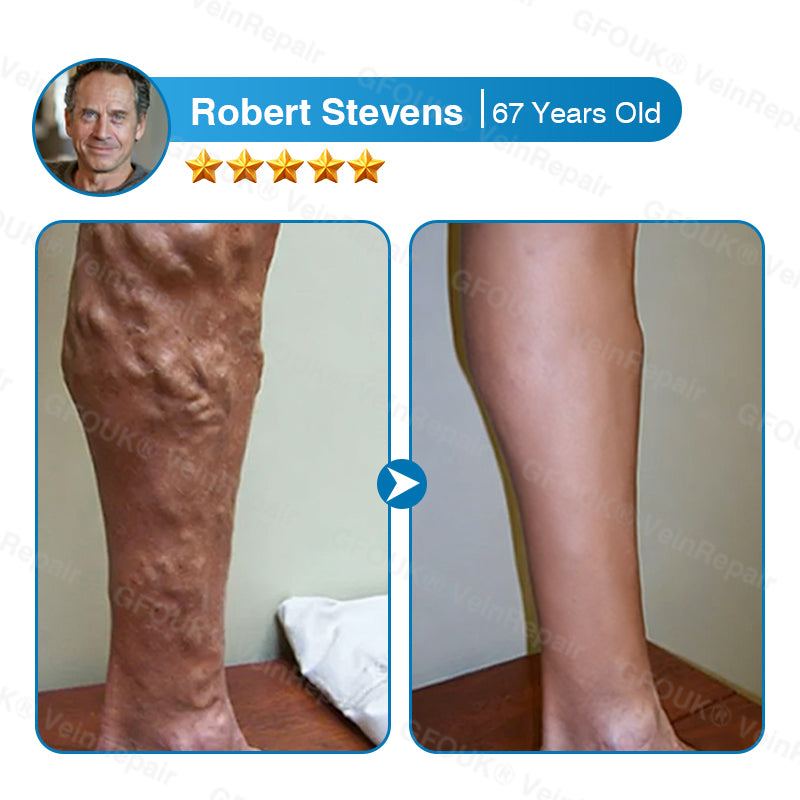 VeinRepair Microneedle Patch Roll⚡Instant Relief, Long-Term Results