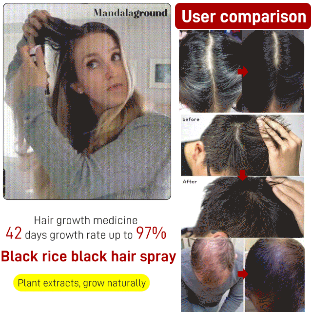 👍 Stimulate hair follicles, stop hair loss ✅ White hair turns black, Say goodbye to hair loss and gray hair! 🍃 More than a dozen Chinese herbal ingredients that do not harm the scalp! ✅ at least ten years younger!