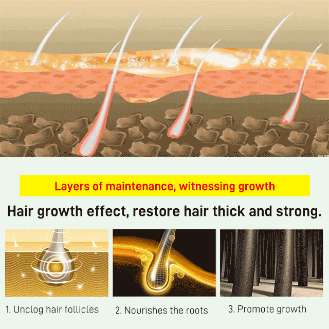 👍 Stimulate hair follicles, stop hair loss ✅ White hair turns black, Say goodbye to hair loss and gray hair! 🍃 More than a dozen Chinese herbal ingredients that do not harm the scalp! ✅ at least ten years younger!