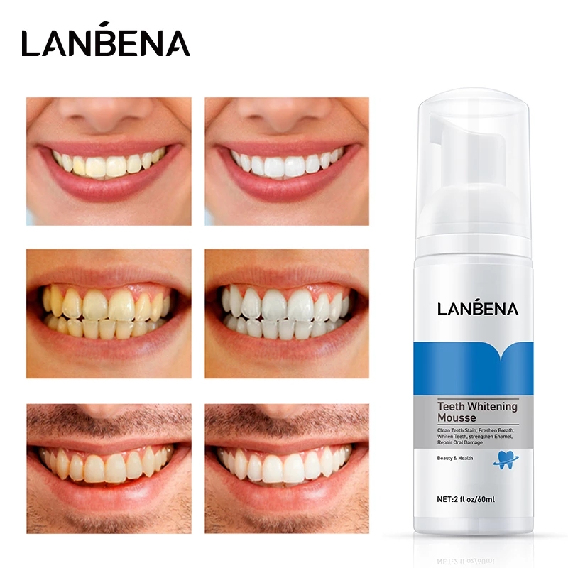 LANBENA Teeth Whitening Mousse Teeth Whitening and Deodorization Technology