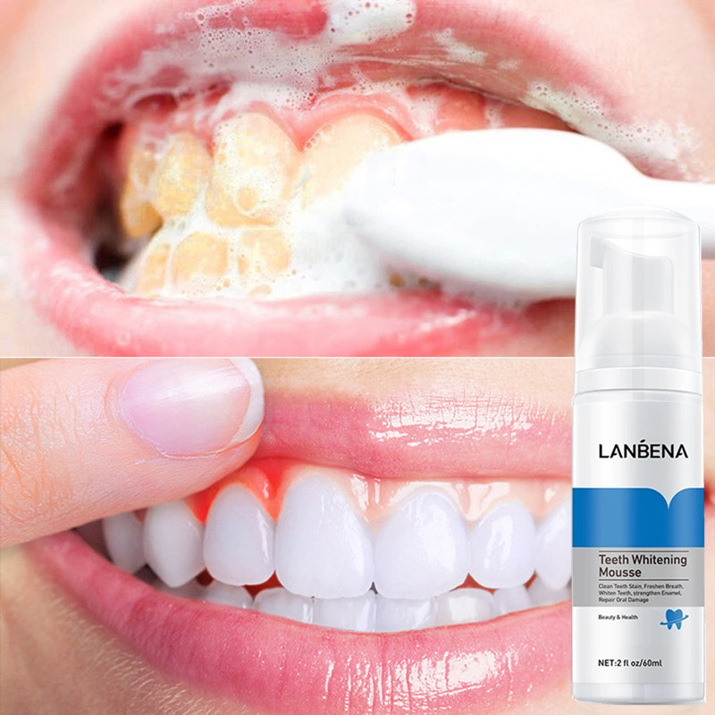 LANBENA Teeth Whitening Mousse Teeth Whitening and Deodorization Technology