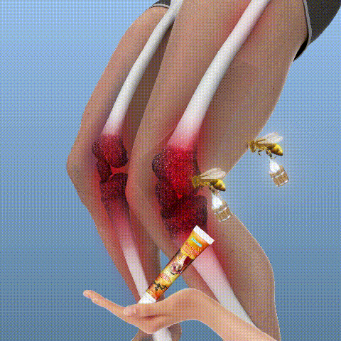 (Buy 1, Get 2 Free, Full Refund If No Visible Results Within 3 Weeks) BeeVenom™ New Zealand Professional Bee Venom Treatment Gel