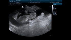 1705459541607679.gif 动3.gif