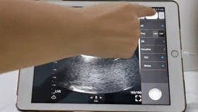 1705459576616548.gif 动5.gif