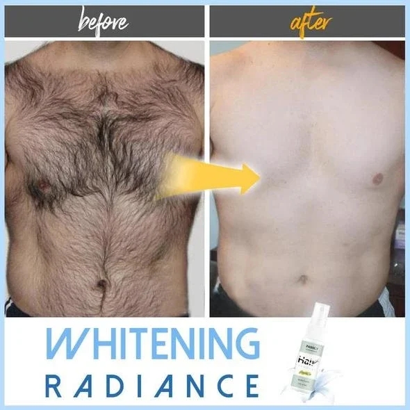 🔥BUY 2 GET 1 FREE!! Semi-permanent Hair Removal Spray