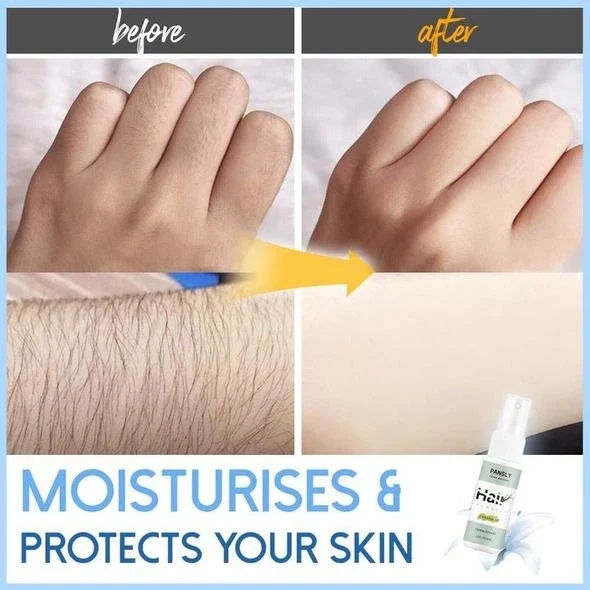 🔥BUY 2 GET 1 FREE!! Semi-permanent Hair Removal Spray