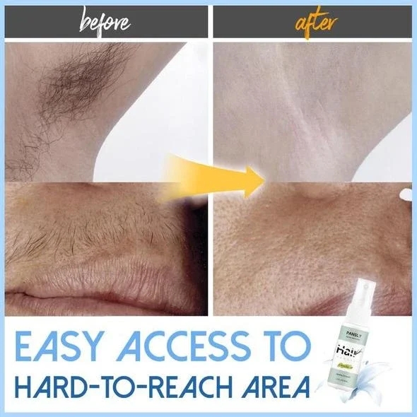 🔥BUY 2 GET 1 FREE!! Semi-permanent Hair Removal Spray