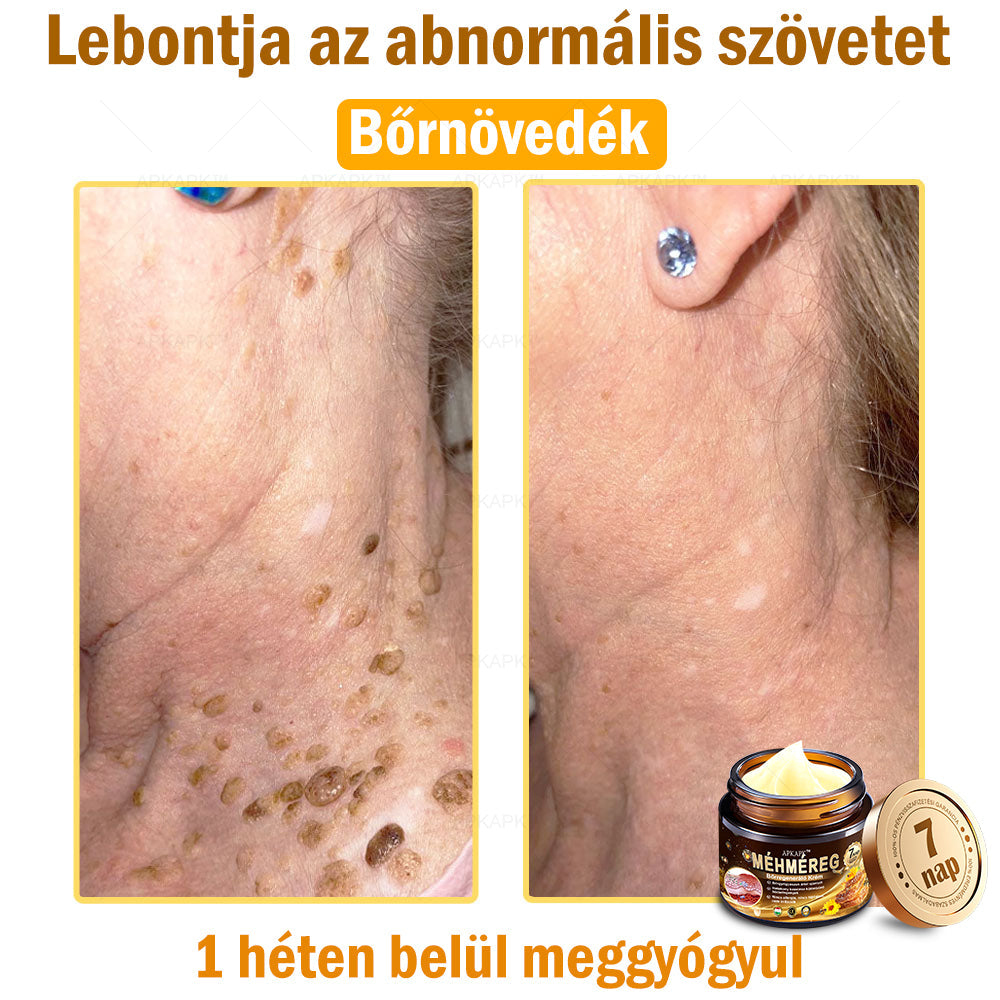 Nourishing Bee Venom Cream – Firming and Anti-Wrinkle