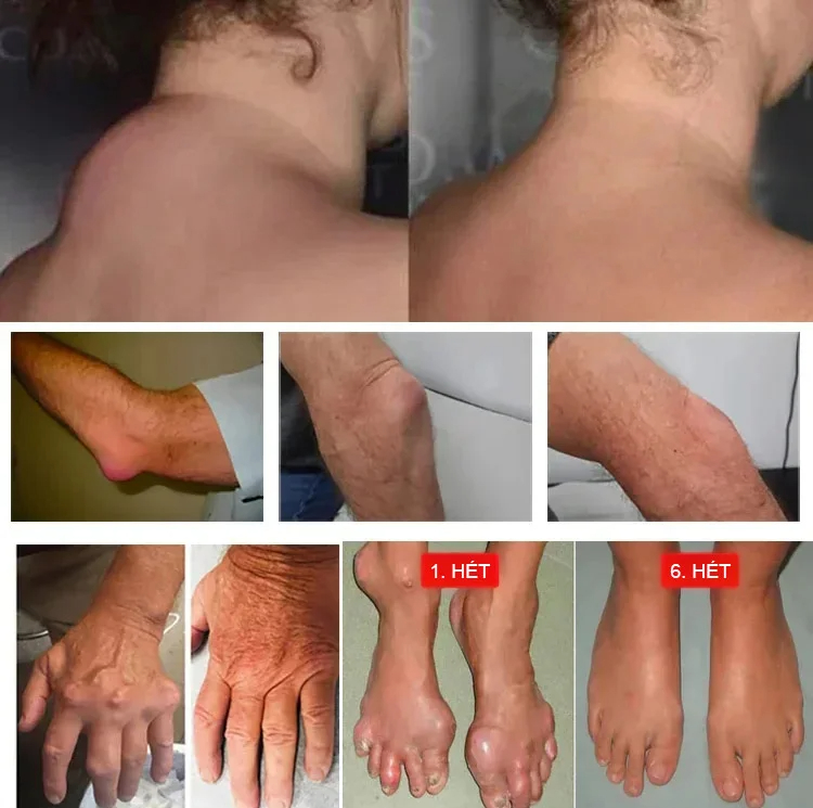 Muscle relaxant and pain reliever Miaojiang joint balm