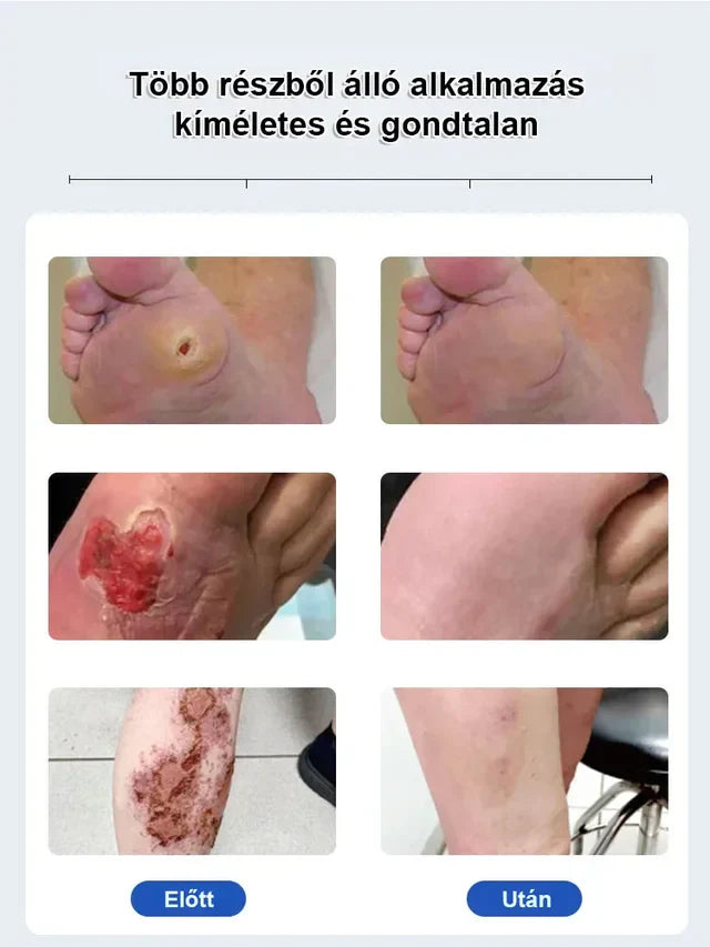 VitaGluco Diabetes Treatment Cream (BUY 1 GET 1 FREE)