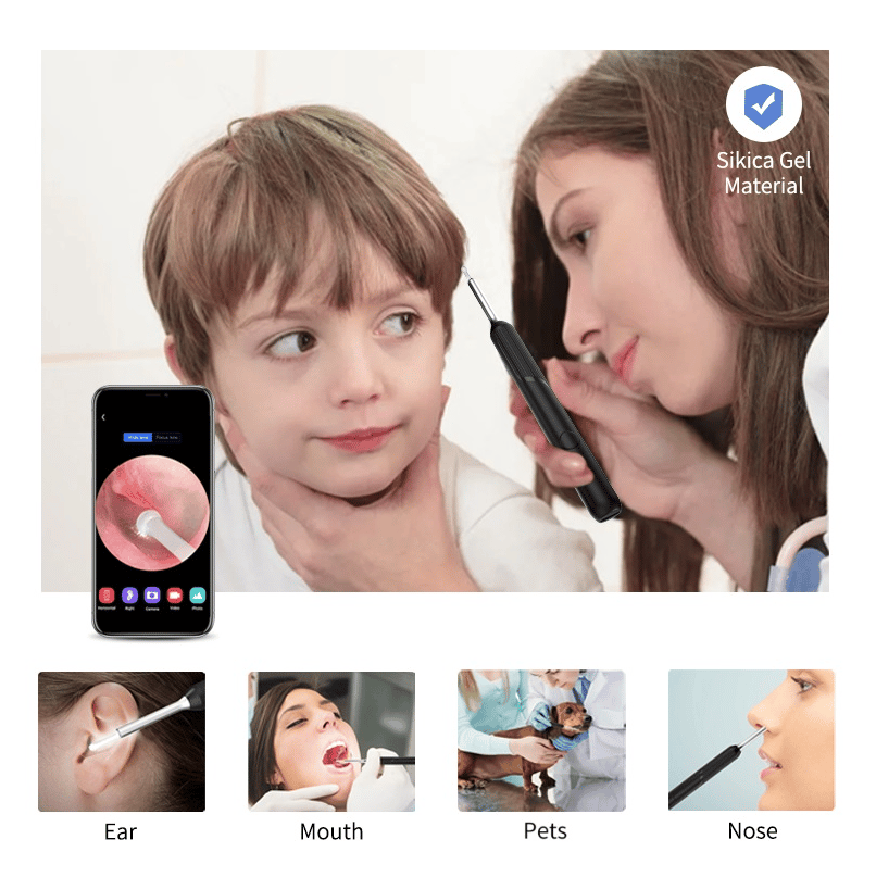 🎁LAST DAY PROMOTION 49%OFF🎁 WI -FI VISIBLE WAX ELIMINATION SPOON-USB 1080P HD LOAD OTOSCOPE