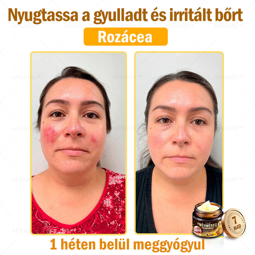 Nourishing Bee Venom Cream – Firming and Anti-Wrinkle