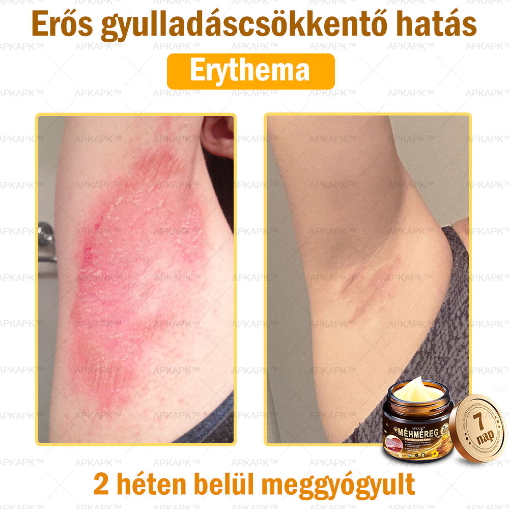 Nourishing Bee Venom Cream – Firming and Anti-Wrinkle