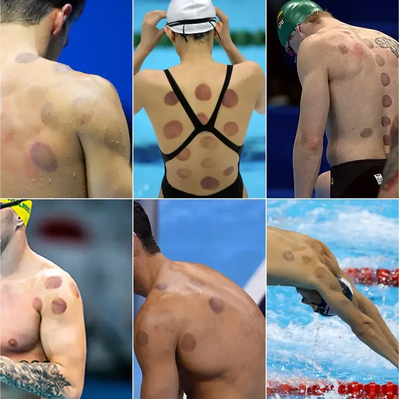 Cupping Set, 6 Cups Cupping Kit for Massage Therapy, Chinese Cupping Therapy Set with Magnetics, Professional Vacuum Cupping Set for Cellulite Reduction Muscle Pain Relief with Manual Pump