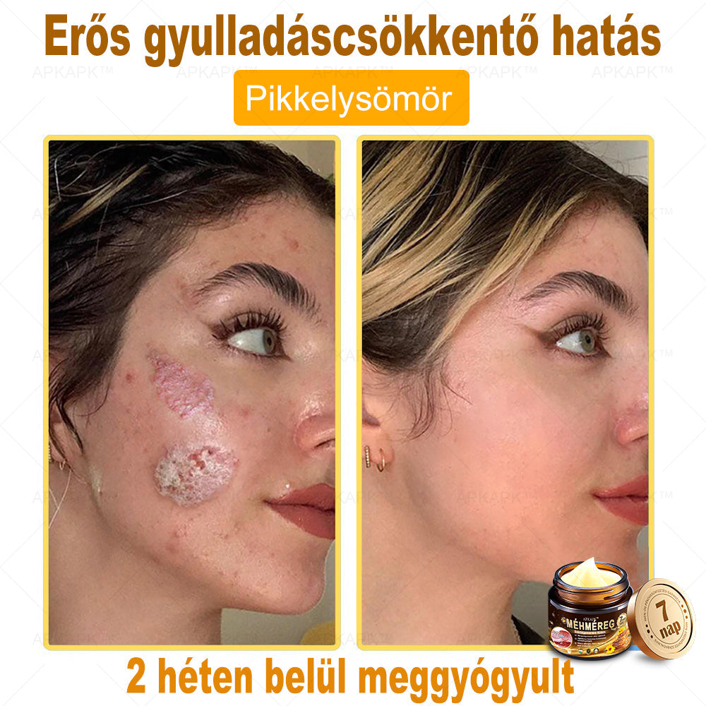 Nourishing Bee Venom Cream – Firming and Anti-Wrinkle