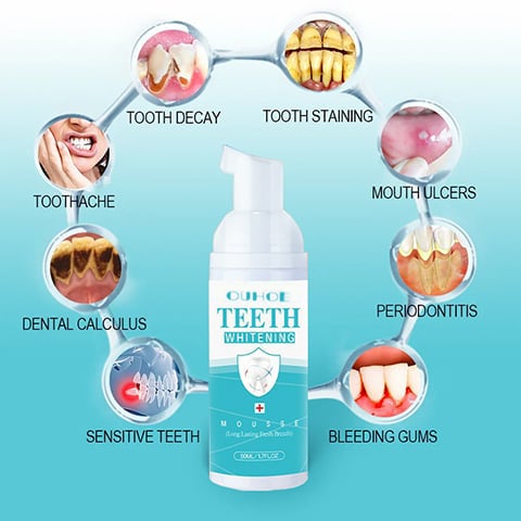 🔥🔥Mouthwash, Calculus Removal, Teeth Whitening, Healing Mouth Ulcers, Eliminating Bad Breath, Preventing and Healing Caries