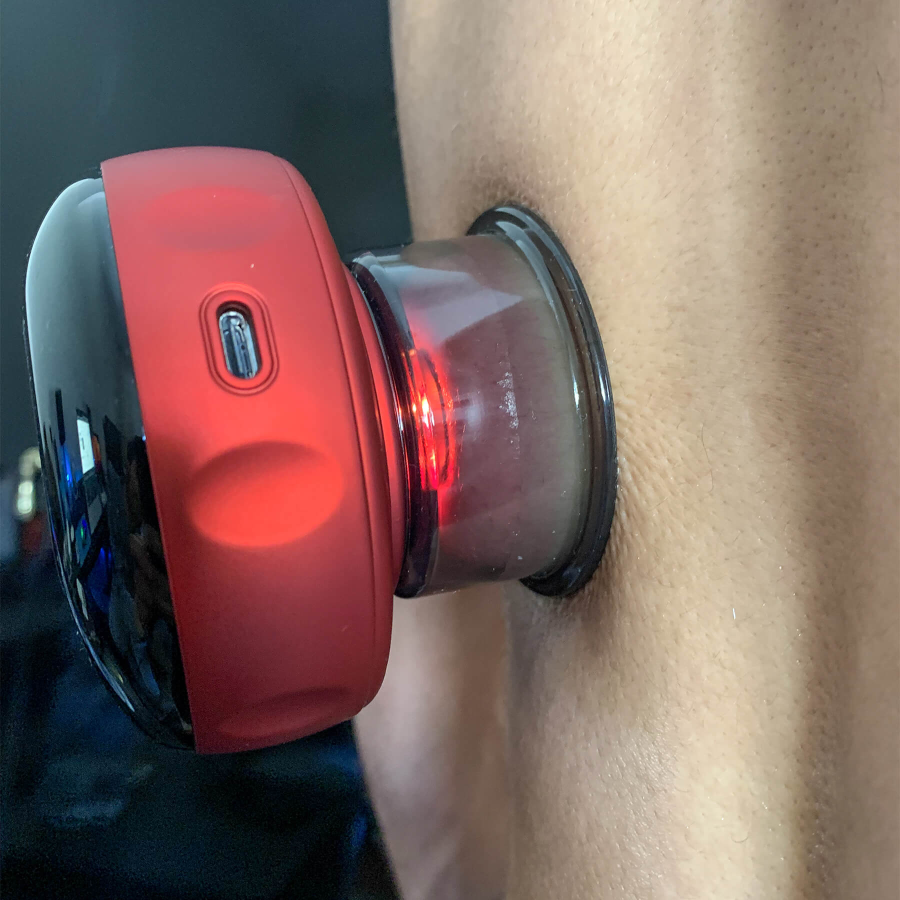 CuppyPro: Advanced Cupping for Athletes