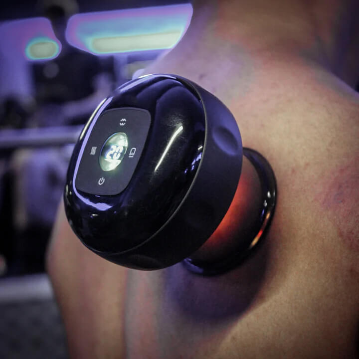 CuppyPro: Advanced Cupping for Athletes