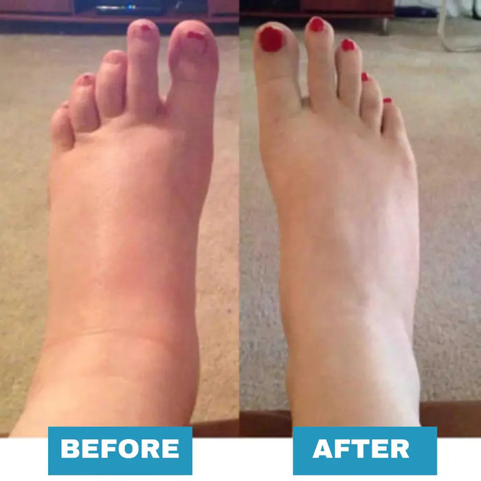 Novelto EMS™ Electric Foot Massager