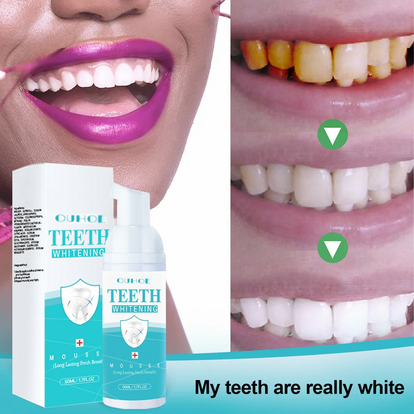 🔥🔥Mouthwash, Calculus Removal, Teeth Whitening, Healing Mouth Ulcers, Eliminating Bad Breath, Preventing and Healing Caries