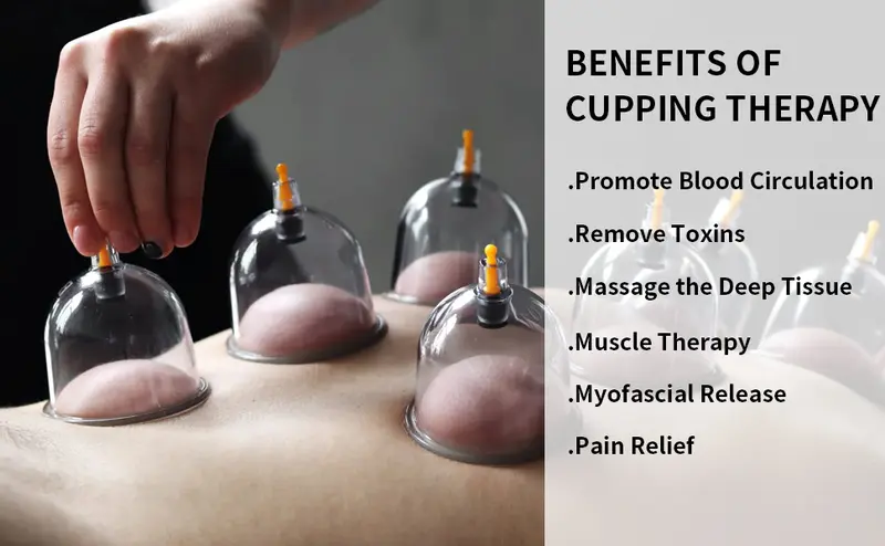 Product Introduction of Cupping Set, 6 Cups Cupping Kit for Massage Therapy, Chinese Cupping Therapy Set with Magnetics, Professional Vacuum Cupping Set for Cellulite Reduction Muscle Pain Relief with Manual Pump 1