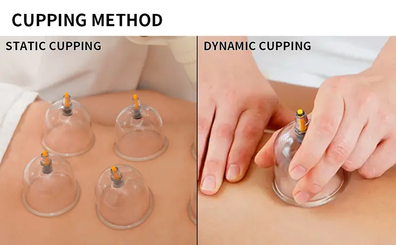 Product Introduction of Cupping Set, 6 Cups Cupping Kit for Massage Therapy, Chinese Cupping Therapy Set with Magnetics, Professional Vacuum Cupping Set for Cellulite Reduction Muscle Pain Relief with Manual Pump 4