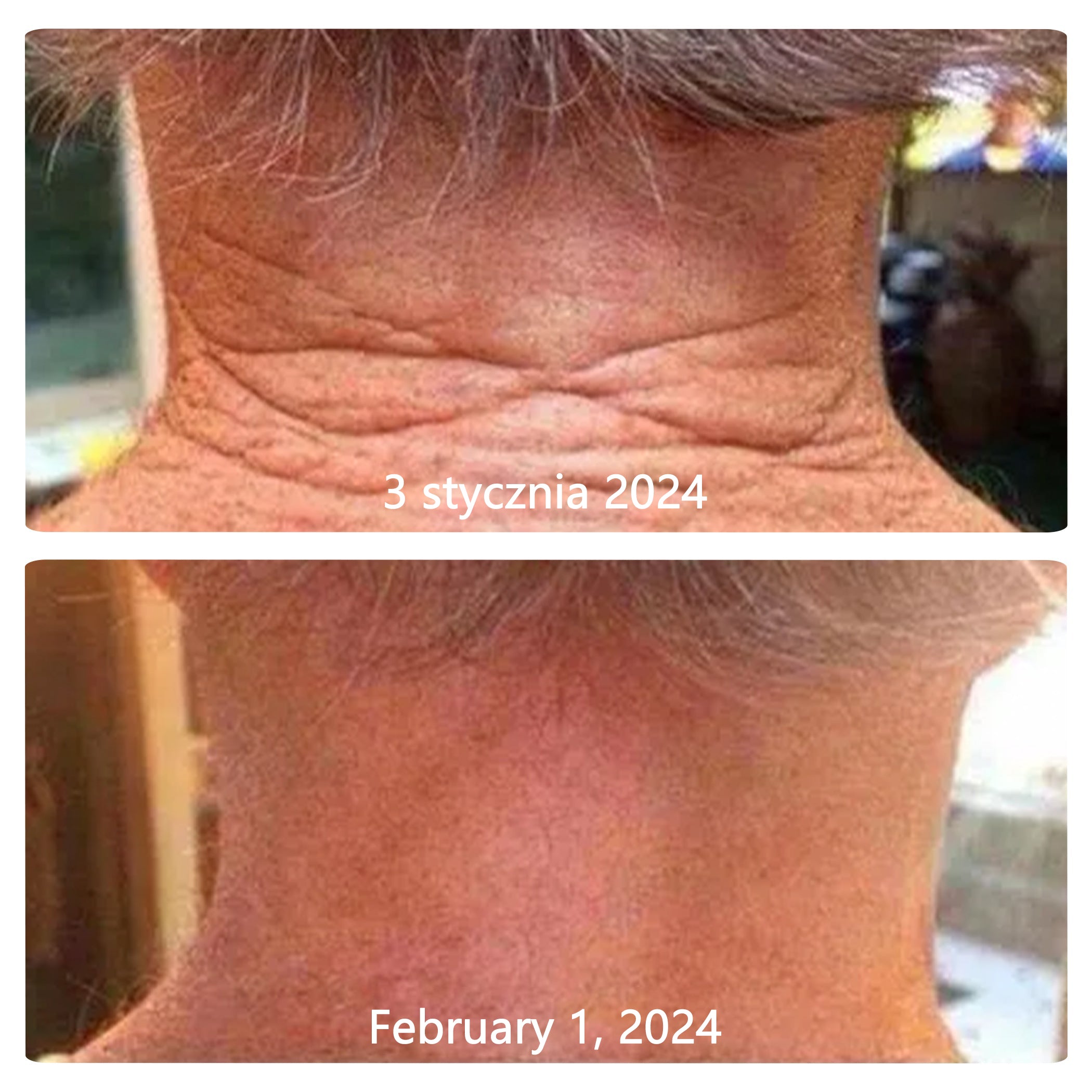 Collagen Peptides FIRMING SERUM STICK🎄🎄🎄 – National Institute of Hygiene (PZH) and the Polish Dermatological Society (PTD), guaranteeing the highest quality and safety for your skin.