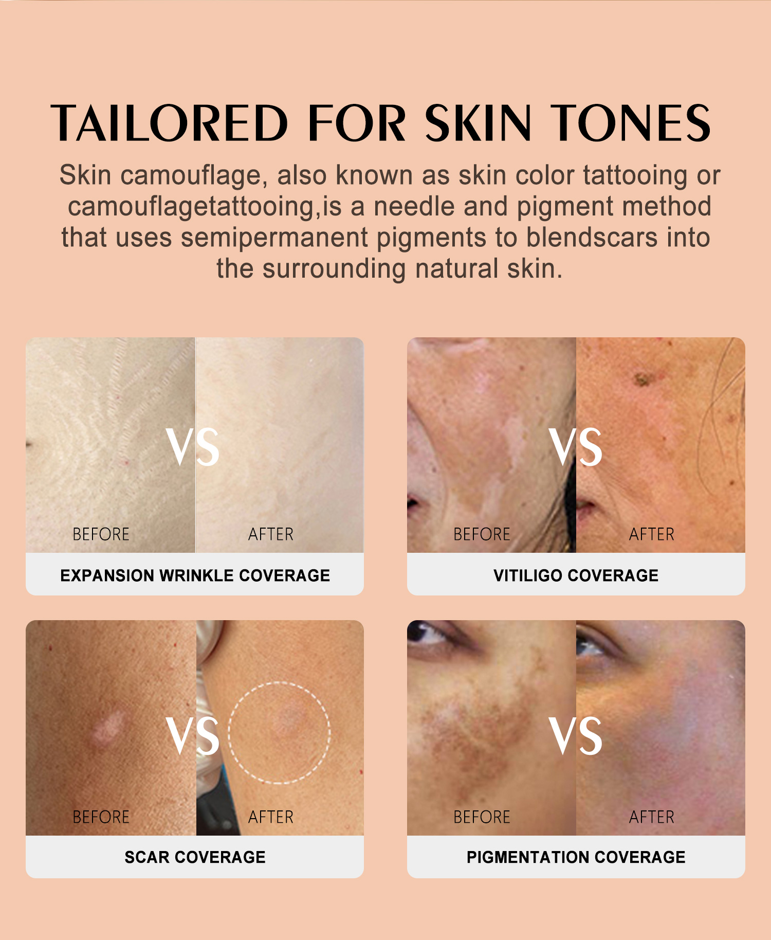 YD Skin Camouflouge 20 Colors With Skin Reader Set