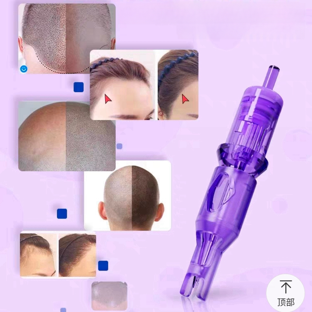 Tattoo & Scalp Tattoo two-in-one machine cartridge 20pcs/box