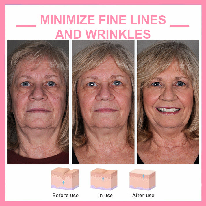✨Last Day Promotion 49% OFF - B5Botox Face Serum