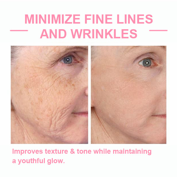 ✨Last Day Promotion 49% OFF - B5Botox Face Serum