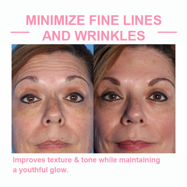 ✨Last Day Promotion 49% OFF - B5Botox Face Serum