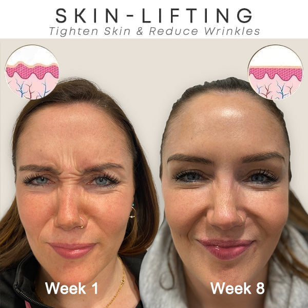 ✨Last Day Promotion 49% OFF - B5Botox Face Serum
