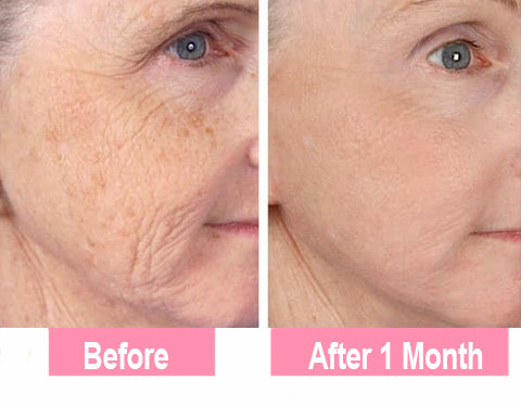 ✨Last Day Promotion 49% OFF - B5Botox Face Serum