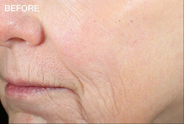 ✨Last Day Promotion 49% OFF - B5Botox Face Serum