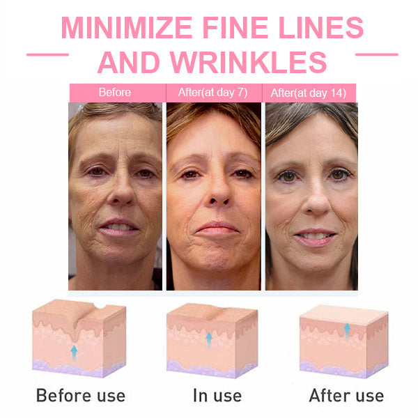 ✨Last Day Promotion 49% OFF - B5Botox Face Serum