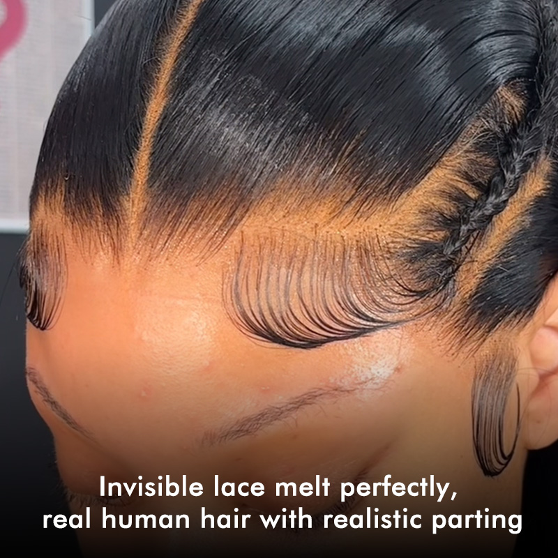 Burmese Hair Loose Deep Lace Closure