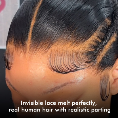 Burmese Hair Loose Deep Lace Closure